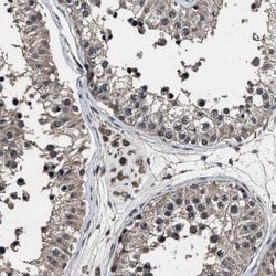 Invitrogen RSBN1L Polyclonal Antibody 100 &mu;L; Unconjugated:Antibodies,