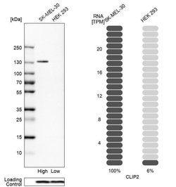 Invitrogen CLIP2 Polyclonal Antibody 100 &mu;L; Unconjugated:Antibodies,
