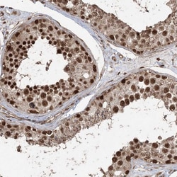 Invitrogen ZNF839 Polyclonal Antibody 100 &mu;L; Unconjugated:Antibodies,
