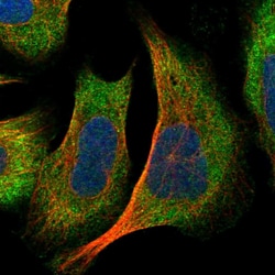 Invitrogen DNAJC2 Polyclonal Antibody 100 &mu;L; Unconjugated:Antibodies,