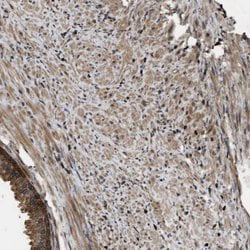 Invitrogen DNAJC2 Polyclonal Antibody 100 &mu;L; Unconjugated:Antibodies,