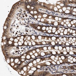 Invitrogen KLHDC1 Polyclonal Antibody 100 &mu;L; Unconjugated:Antibodies,