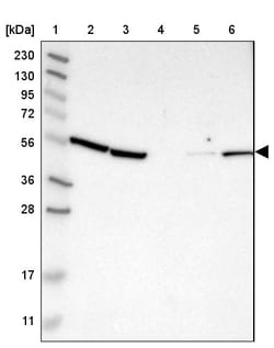 Invitrogen KLHDC1 Polyclonal Antibody 100 &mu;L; Unconjugated:Antibodies,
