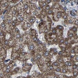 Invitrogen NDUFV3 Polyclonal Antibody 100 &mu;L | Buy Online | Invitrogen&trade; | Fisher Scientific