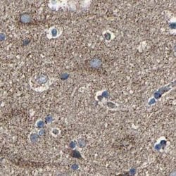 Invitrogen NDUFV3 Polyclonal Antibody 100 &mu;L | Buy Online | Invitrogen&trade; | Fisher Scientific