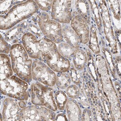 Invitrogen MALSU1 Polyclonal Antibody 100 &mu;L | Buy Online | Invitrogen&trade; | Fisher Scientific