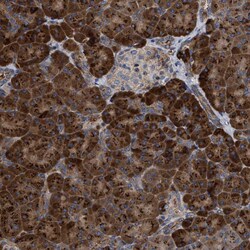 Invitrogen MALSU1 Polyclonal Antibody 100 &mu;L | Buy Online | Invitrogen&trade; | Fisher Scientific