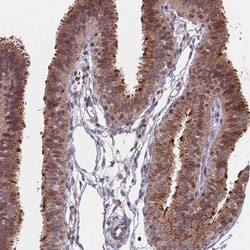 Invitrogen ACN9 Polyclonal Antibody 100 &mu;L; Unconjugated:Antibodies