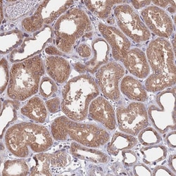 Invitrogen ACN9 Polyclonal Antibody 100 &mu;L; Unconjugated:Antibodies