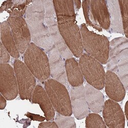 Invitrogen ACN9 Polyclonal Antibody 100 &mu;L; Unconjugated:Antibodies