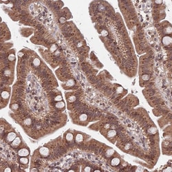 Invitrogen ACN9 Polyclonal Antibody 100 &mu;L; Unconjugated:Antibodies