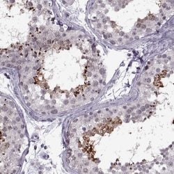 Invitrogen PRSS37 Polyclonal Antibody 100 &mu;L; Unconjugated:Antibodies,