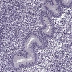 Invitrogen PRSS37 Polyclonal Antibody 100 &mu;L; Unconjugated:Antibodies,