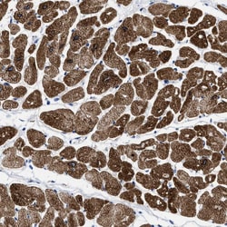 Invitrogen TBRG4 Polyclonal Antibody 100 &mu;L; Unconjugated:Antibodies,