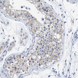 Invitrogen TBRG4 Polyclonal Antibody 100 &mu;L; Unconjugated:Antibodies,