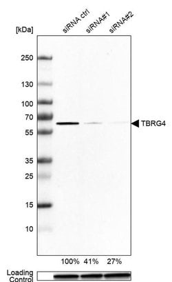 Invitrogen TBRG4 Polyclonal Antibody 100 &mu;L; Unconjugated:Antibodies,