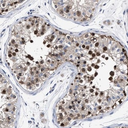 Invitrogen MIS18A Polyclonal Antibody 100 &mu;L; Unconjugated:Antibodies,