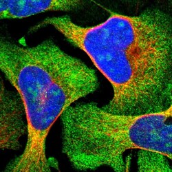 Invitrogen ZCCHC7 Polyclonal Antibody 100 &mu;L; Unconjugated:Antikörper