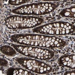 Invitrogen ZCCHC7 Polyclonal Antibody 100 &mu;L; Unconjugated:Antikörper