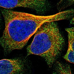 Invitrogen IPPK Polyclonal Antibody 100 &mu;L; Unconjugated:Antibodies,