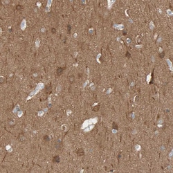 Invitrogen IPPK Polyclonal Antibody 100 &mu;L; Unconjugated:Antibodies,