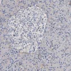 Invitrogen IPPK Polyclonal Antibody 100 &mu;L; Unconjugated:Antibodies,