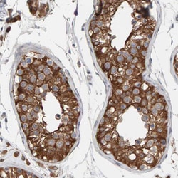 Invitrogen IPPK Polyclonal Antibody 100 &mu;L; Unconjugated:Antibodies,