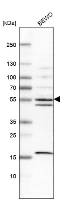 Invitrogen IPPK Polyclonal Antibody 100 &mu;L; Unconjugated:Antibodies,
