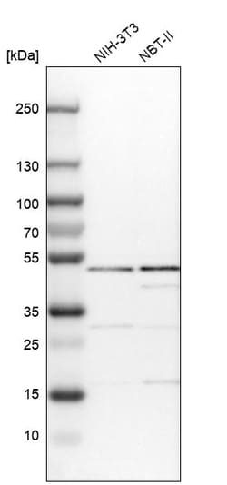 Invitrogen IPPK Polyclonal Antibody 100 &mu;L; Unconjugated:Antibodies,