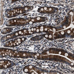 Invitrogen WDR60 Polyclonal Antibody 100 &mu;L; Unconjugated:Antibodies,