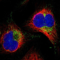 Invitrogen AASS Polyclonal Antibody 100 &mu;L; Unconjugated:Antibodies,