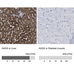 Invitrogen AASS Polyclonal Antibody 100 &mu;L; Unconjugated:Antibodies,