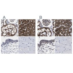 Invitrogen AASS Polyclonal Antibody 100 &mu;L; Unconjugated:Antibodies,