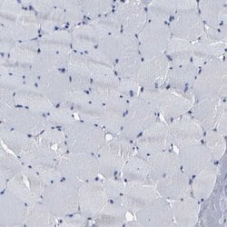 Invitrogen AASS Polyclonal Antibody 100 &mu;L; Unconjugated:Antibodies,