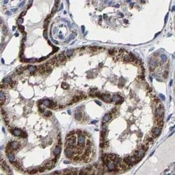 Invitrogen AASS Polyclonal Antibody 100 &mu;L; Unconjugated:Antibodies,