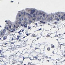 Invitrogen AASS Polyclonal Antibody 100 &mu;L; Unconjugated:Antibodies,