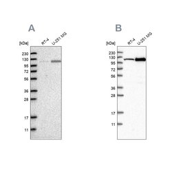 Invitrogen AASS Polyclonal Antibody 100 &mu;L; Unconjugated:Antibodies,