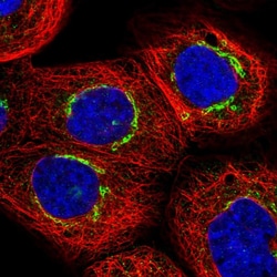 Invitrogen ZMYND19 Polyclonal Antibody 100 &mu;L; Unconjugated:Antibodies,