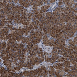 Invitrogen TEX2 Polyclonal Antibody 100 &mu;L; Unconjugated:Antibodies,