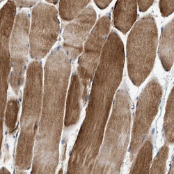 Invitrogen TEX2 Polyclonal Antibody 100 &mu;L; Unconjugated:Antibodies,