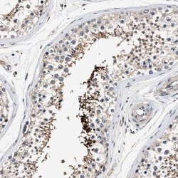 Invitrogen TEX2 Polyclonal Antibody 100 &mu;L; Unconjugated:Antibodies,