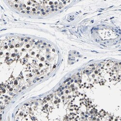 Invitrogen STRBP Polyclonal Antibody 100 &mu;L; Unconjugated:Antibodies,
