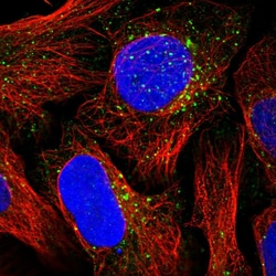 Invitrogen NSUN7 Polyclonal Antibody 100 &mu;L; Unconjugated:Antibodies,