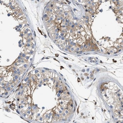Invitrogen NSUN7 Polyclonal Antibody 100 &mu;L; Unconjugated:Antibodies,