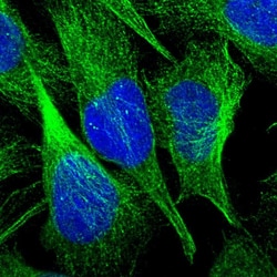Invitrogen CI016 Polyclonal Antibody 100 &mu;L; Unconjugated:Antibodies,