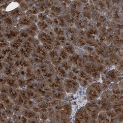 Invitrogen CI016 Polyclonal Antibody 100 &mu;L; Unconjugated:Antibodies,