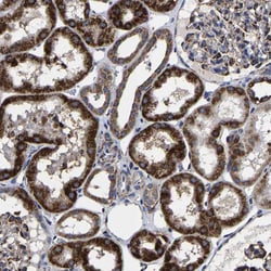 Invitrogen AASS Polyclonal Antibody 100 &mu;L; Unconjugated:Antibodies