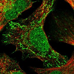 Invitrogen TNRC18 Polyclonal Antibody 100 &mu;L; Unconjugated:Antibodies,