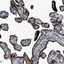 Invitrogen TNRC18 Polyclonal Antibody 100 &mu;L; Unconjugated:Antibodies,