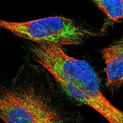 Invitrogen AASS Polyclonal Antibody 100 &mu;L; Unconjugated:Antibodies,